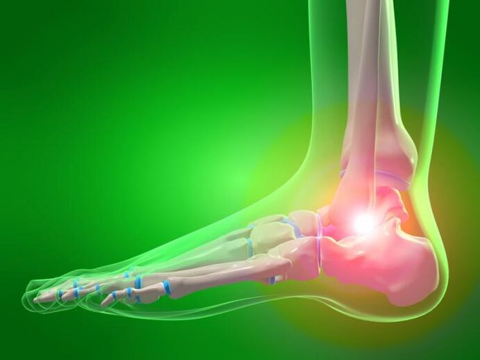 inflammation of the ankle joint with osteoarthritis