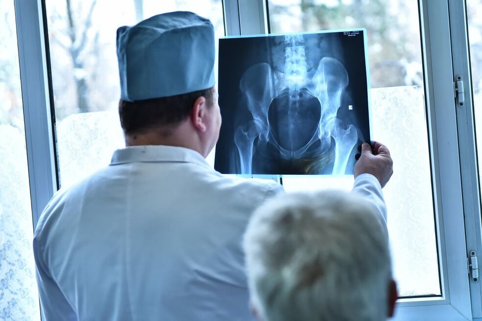 The doctor looks at an image of a hip joint with osteoarthritis.