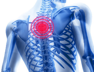 The chest pain of degenerative disc disease